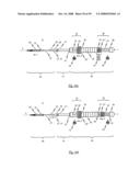 Medical device for treating a heart valve insufficiency or stenosis diagram and image