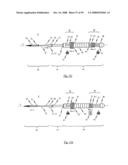 Medical device for treating a heart valve insufficiency or stenosis diagram and image