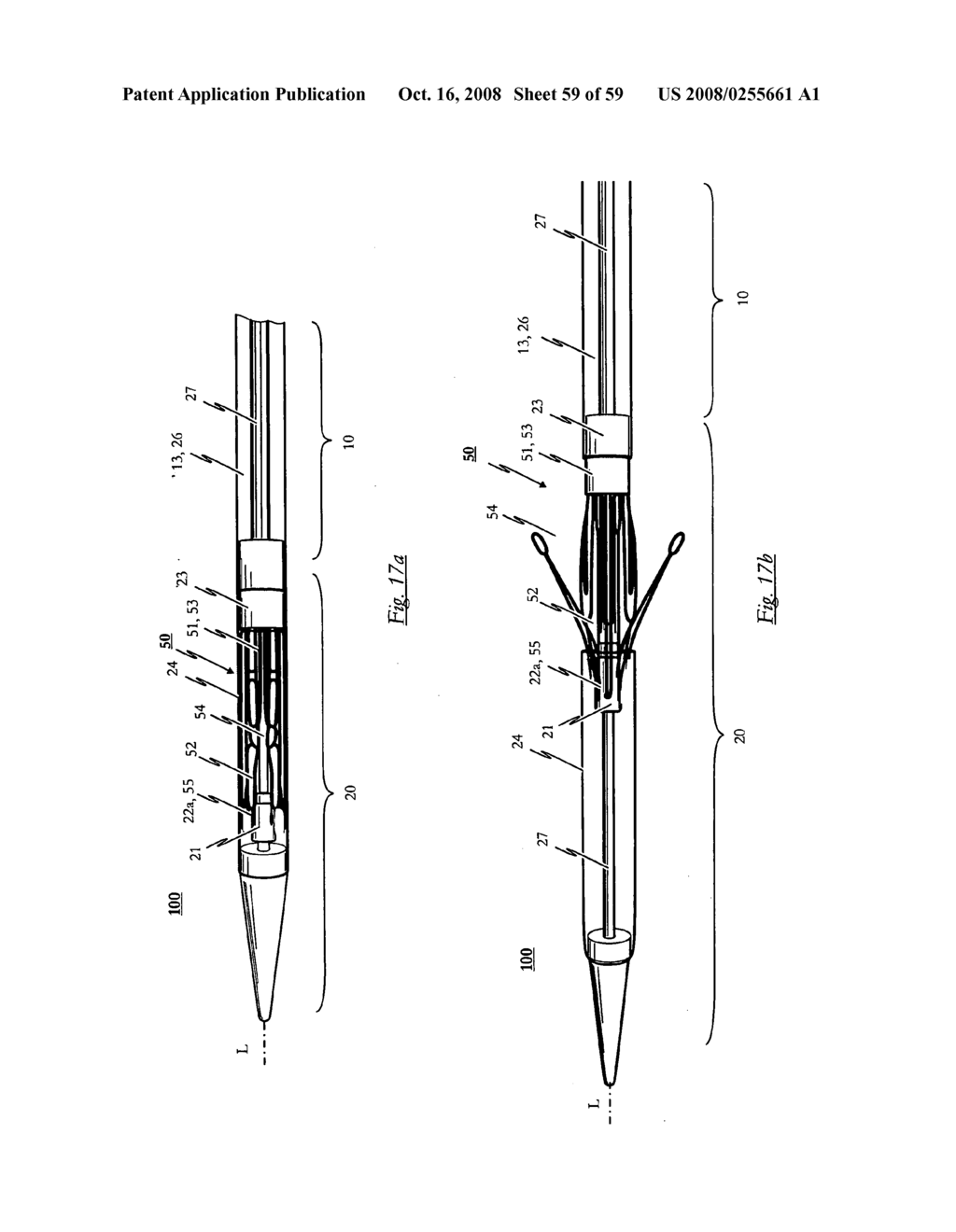 Medical device for treating a heart valve insufficiency or stenosis - diagram, schematic, and image 60