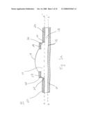 Artificial Cornea and Method of Making Same diagram and image