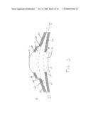 Artificial Cornea and Method of Making Same diagram and image