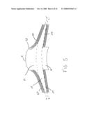 Artificial Cornea and Method of Making Same diagram and image