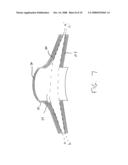 Artificial Cornea and Method of Making Same diagram and image