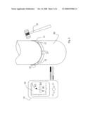 Pole Monitoring Kit, in Particular for Wooden Poles diagram and image