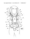 Multi-point tethering system for head and neck restraint devices diagram and image