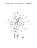 Multi-point tethering system for head and neck restraint devices diagram and image