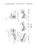 Special and improved configurations for unitized post tension block systems for masonry structures diagram and image