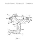 Alloy Casting Apparatus diagram and image