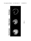 Non iterative shimming in magnetic resonance imaging in the presence of high LIPID levels diagram and image