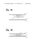 Enclosure And Gasket Assembly For Reducing EMI diagram and image