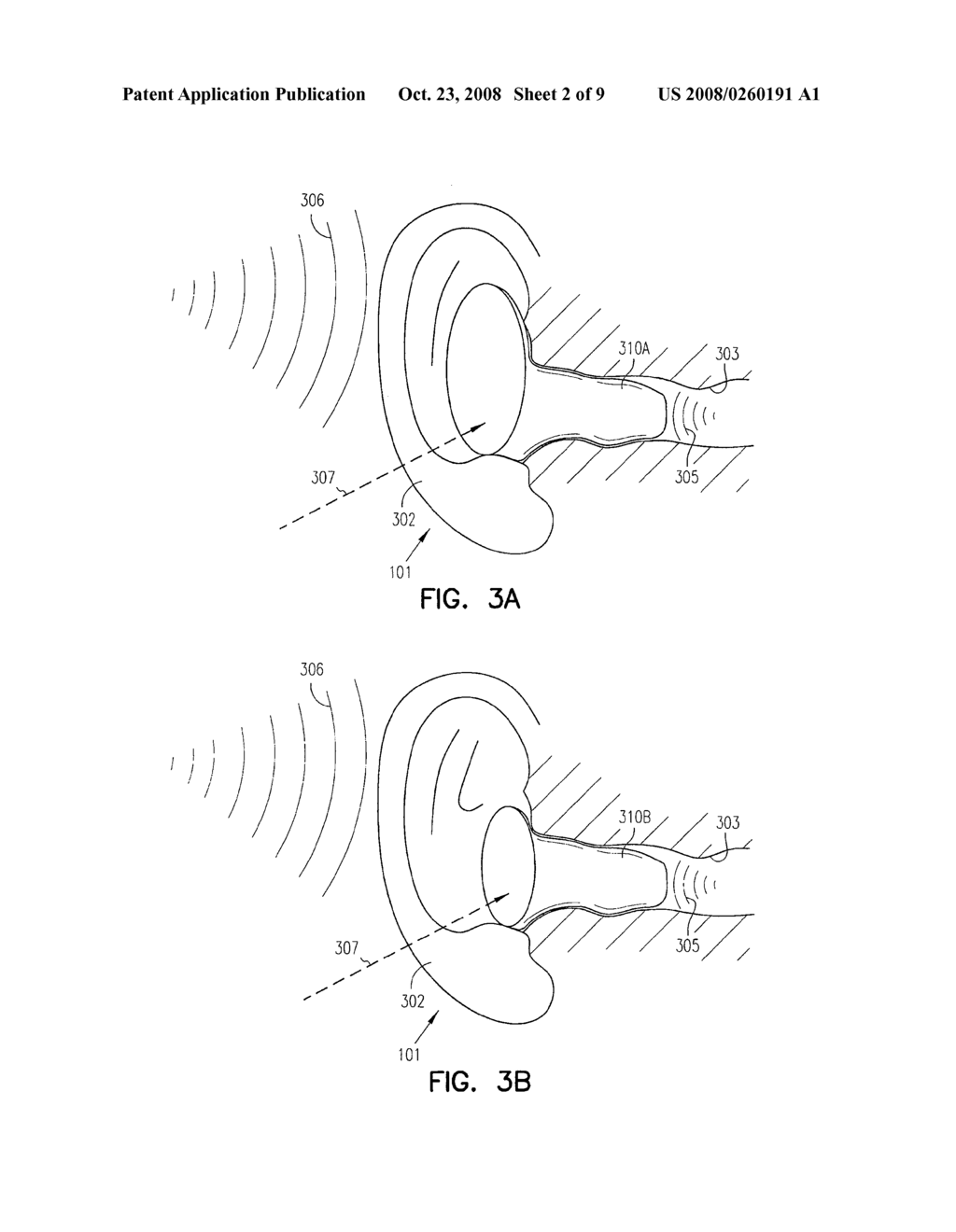 EXTERNAL EAR CANAL VOICE DETECTION - diagram, schematic, and image 03