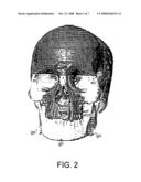 AUTOMATICALLY DETERMINING LANDMARKS ON ANATOMICAL STRUCTURES diagram and image