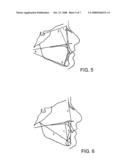 AUTOMATICALLY DETERMINING LANDMARKS ON ANATOMICAL STRUCTURES diagram and image