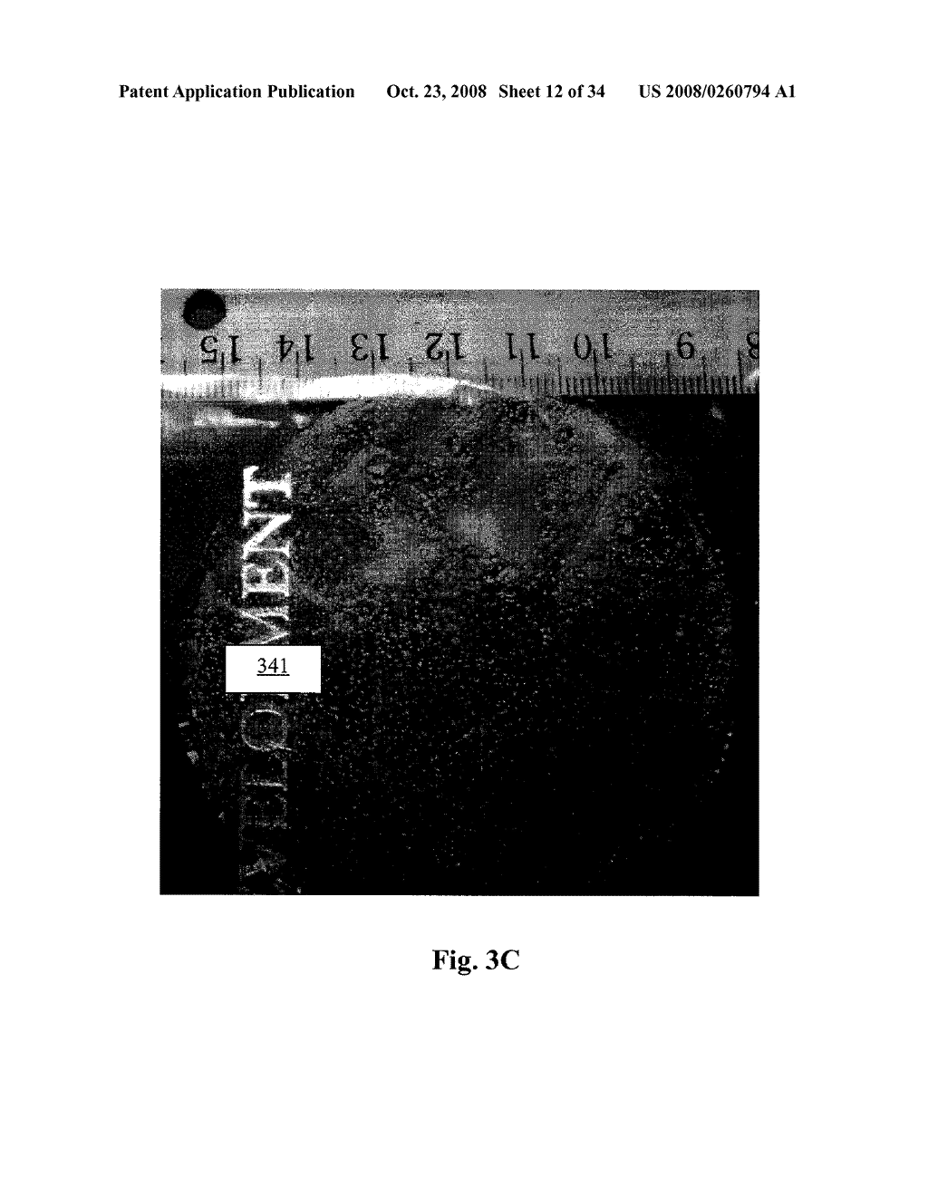 COLLAGEN PRODUCTS AND METHODS FOR PRODUCING COLLAGEN PRODUCTS - diagram, schematic, and image 13