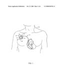 REDUCTION OF INFECTION ASSOCIATED WITH MEDICAL DEVICE diagram and image