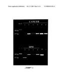 PCA3 Messenger RNA Species in Benign and Malignant Prostate Tissues diagram and image