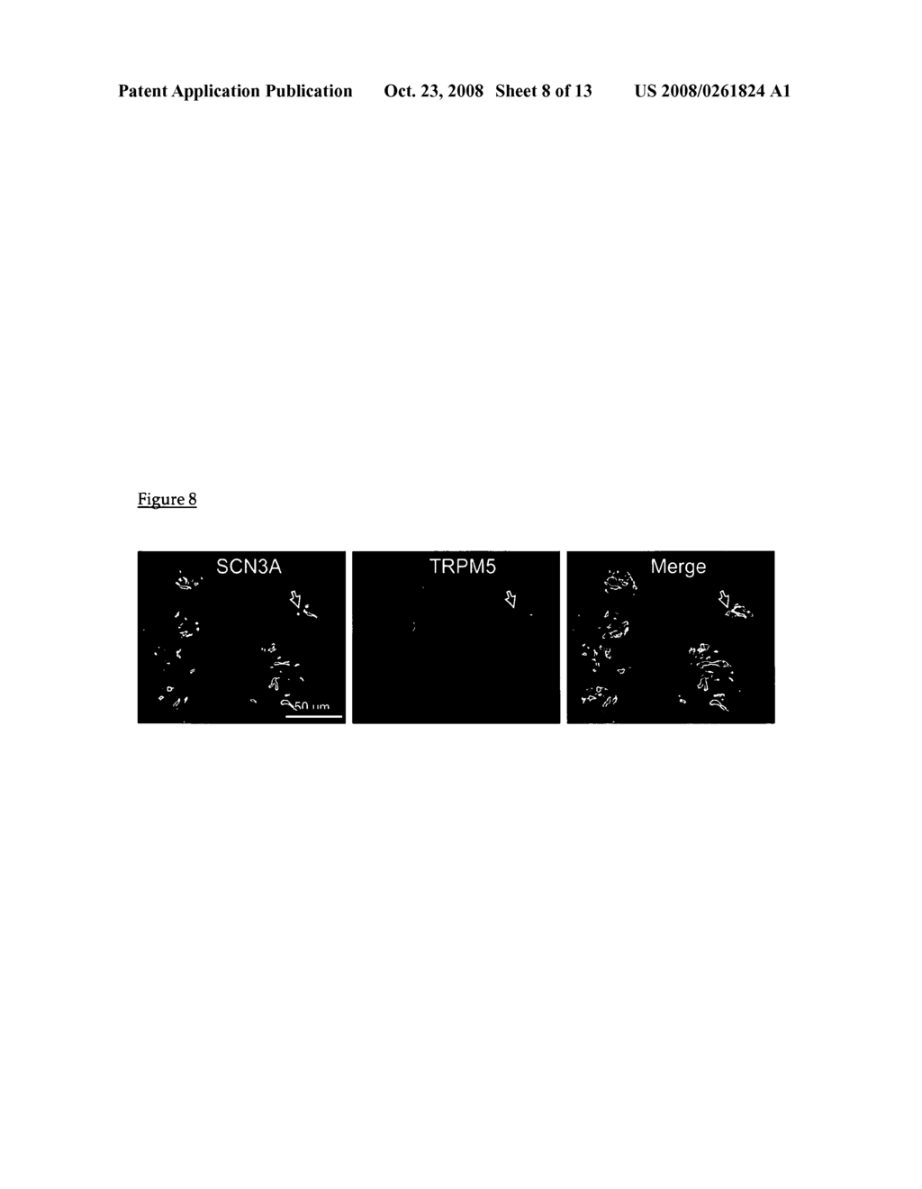 Rationale, methods, and assays for identifying novel taste cell genes and salty taste receptor targets and assays using these identified genes or gene products - diagram, schematic, and image 09