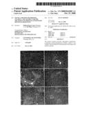 Use of S-Adenosylmethionine, Vitamin E, and Vitamin C for the Treatment of Oxidative Liver Injury or Insulin Resistance diagram and image