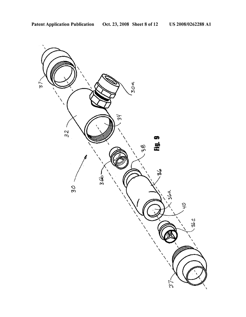 Physiologic pulsatile pump - diagram, schematic, and image 09