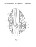 STEERABLE OVERTUBE diagram and image