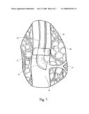 STEERABLE OVERTUBE diagram and image