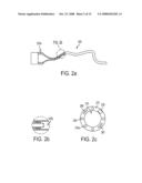 Endoluminal and transluminal surgical methods and devices diagram and image