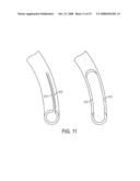 Endoluminal and transluminal surgical methods and devices diagram and image