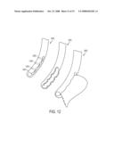 Endoluminal and transluminal surgical methods and devices diagram and image