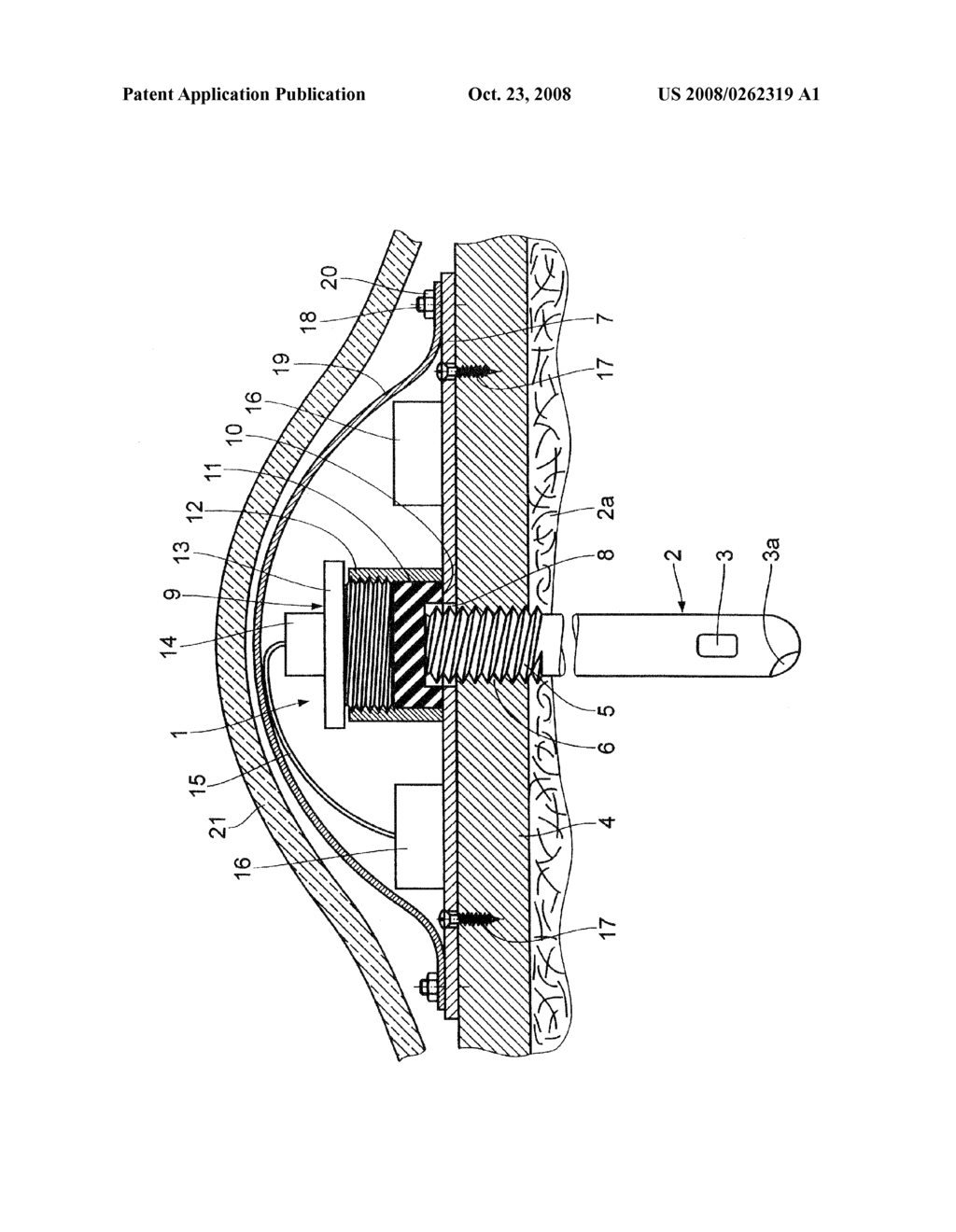 Device for Measuring Brain Parameters - diagram, schematic, and image 02