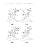 METHOD AND APPARATUS FOR ELECTROMAGNETIC NAVIGATION OF A MAGNETIC STIMULATION PROBE diagram and image