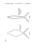 Active blood vessel sleeve methods and systems diagram and image