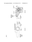 Active blood vessel sleeve methods and systems diagram and image