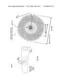 Active blood vessel sleeve methods and systems diagram and image