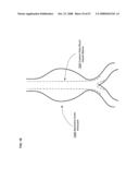 Active blood vessel sleeve methods and systems diagram and image