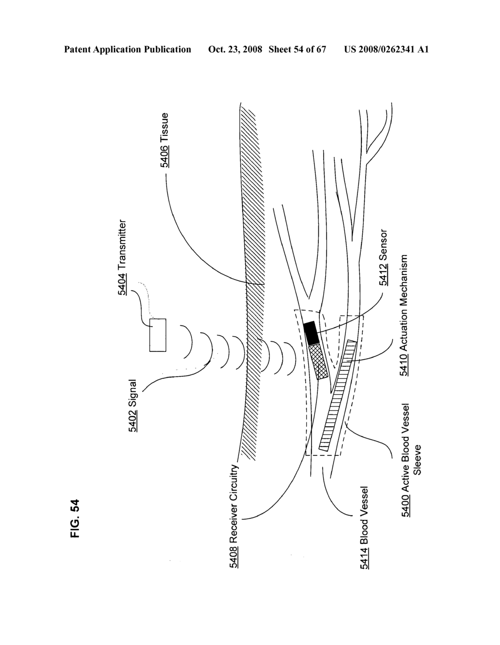 Active blood vessel sleeve methods and systems - diagram, schematic, and image 55