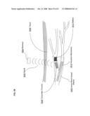 Active blood vessel sleeve methods and systems diagram and image