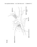 Active blood vessel sleeve methods and systems diagram and image