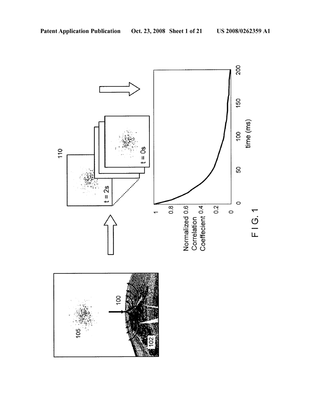 SYSTEM AND METHOD PROVIDING INTRACORONARY LASER SPECKLE IMAGING FOR THE DETECTION OF VULNERABLE PLAQUE - diagram, schematic, and image 02