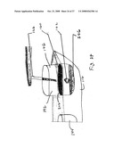 Method and Devices for Screening Cervical Cancer diagram and image