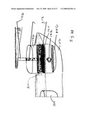 Method and Devices for Screening Cervical Cancer diagram and image