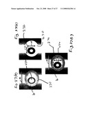 Method and Devices for Screening Cervical Cancer diagram and image