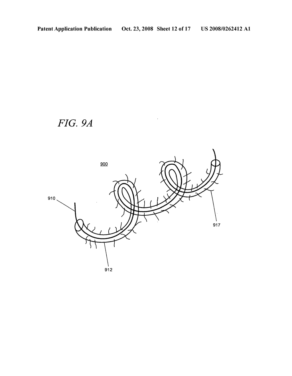 Internal medical devices for delivery of therapeutic agent in conjunction with a source of electrical power - diagram, schematic, and image 13