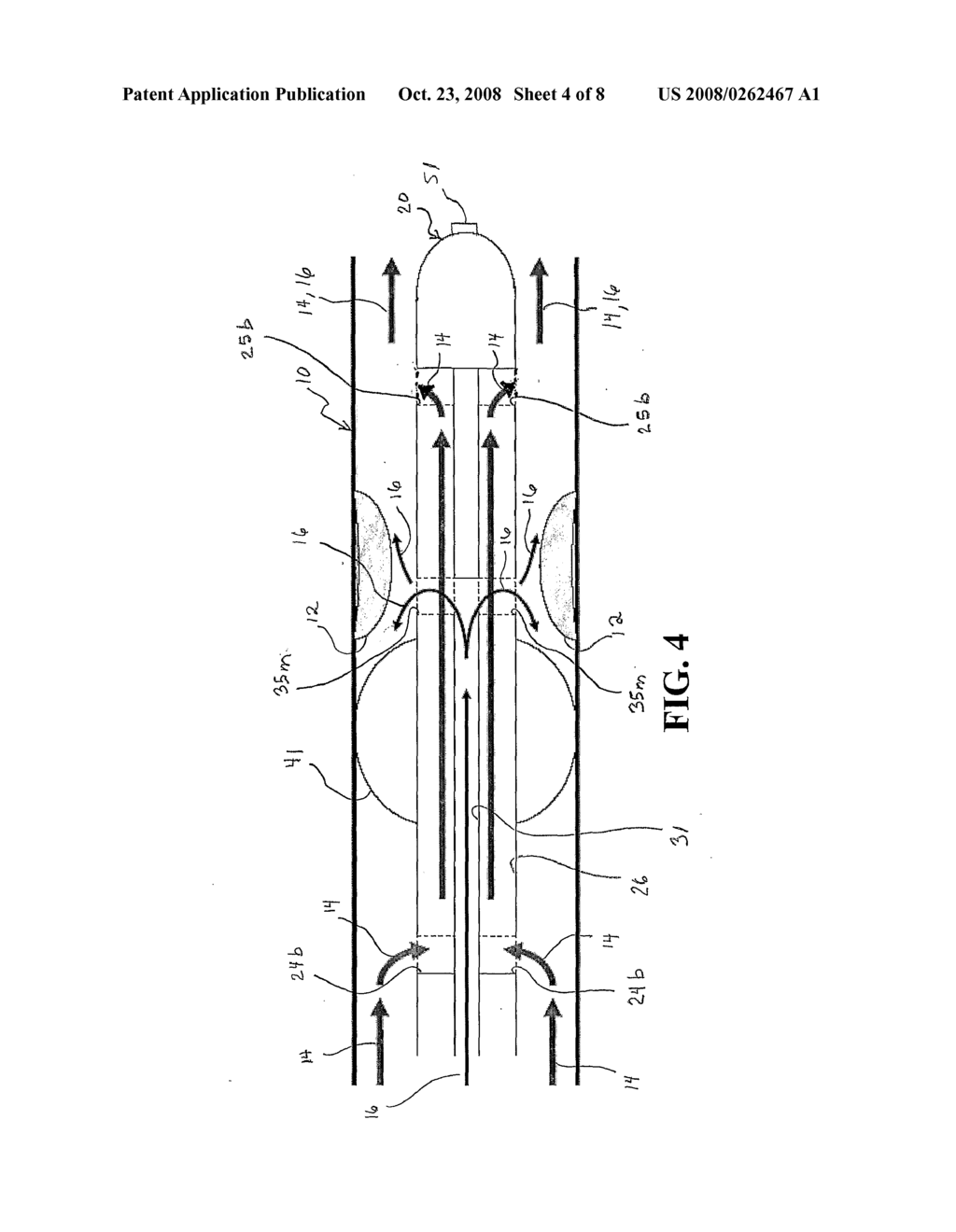 Blood Flow Bypass Catheters and Methods for the Delivery of Medium to the Vasculature and Body Ducts - diagram, schematic, and image 05