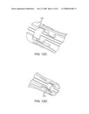 Thrombus removal diagram and image