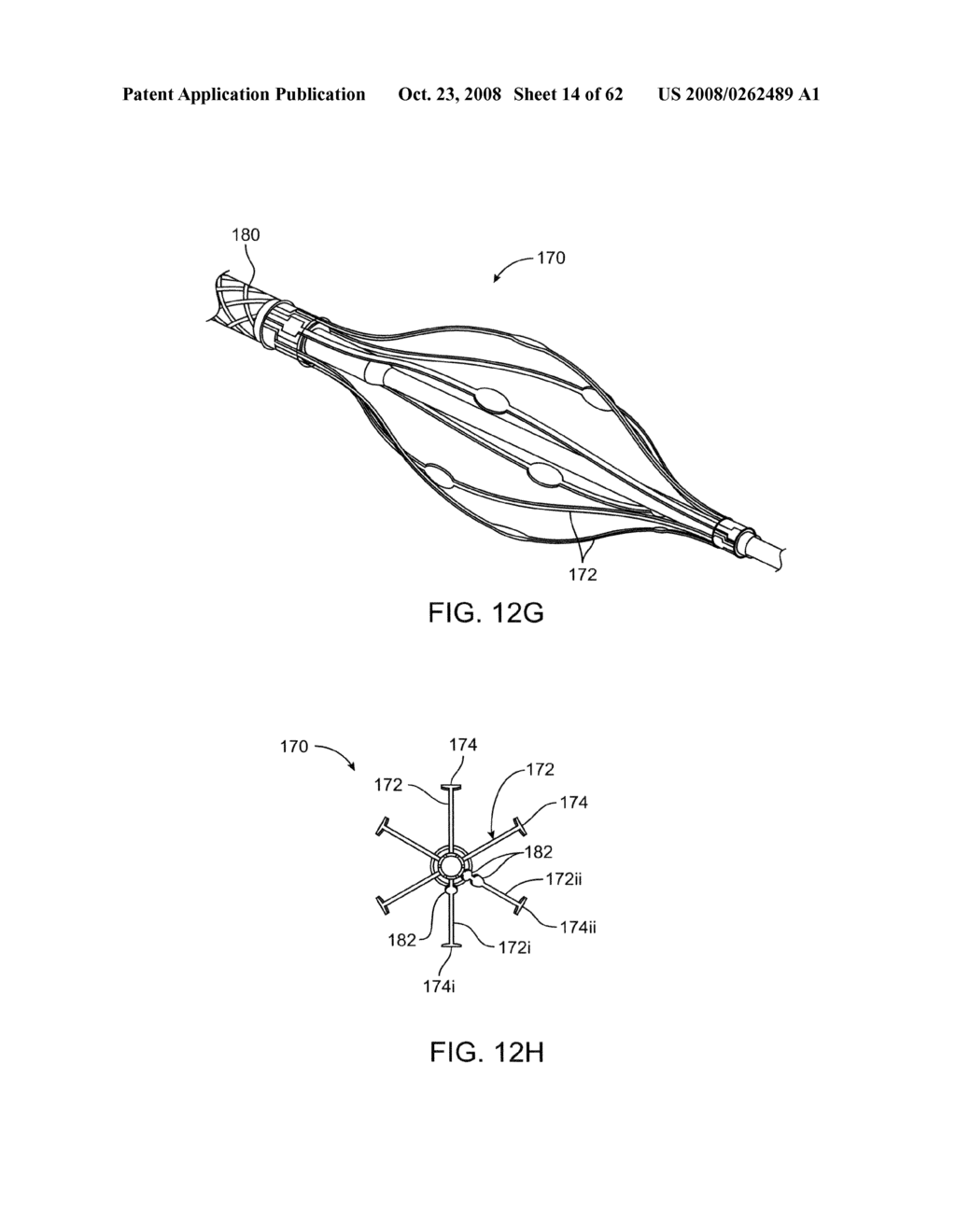 Thrombus removal - diagram, schematic, and image 15