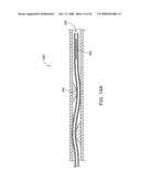 Thrombus removal diagram and image