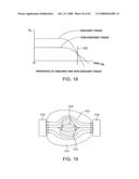 Thrombus removal diagram and image