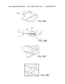 Thrombus removal diagram and image