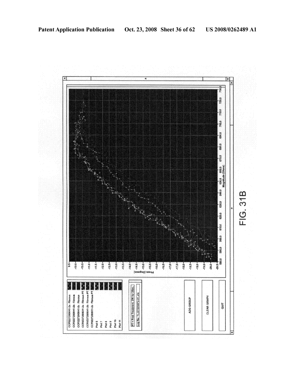 Thrombus removal - diagram, schematic, and image 37