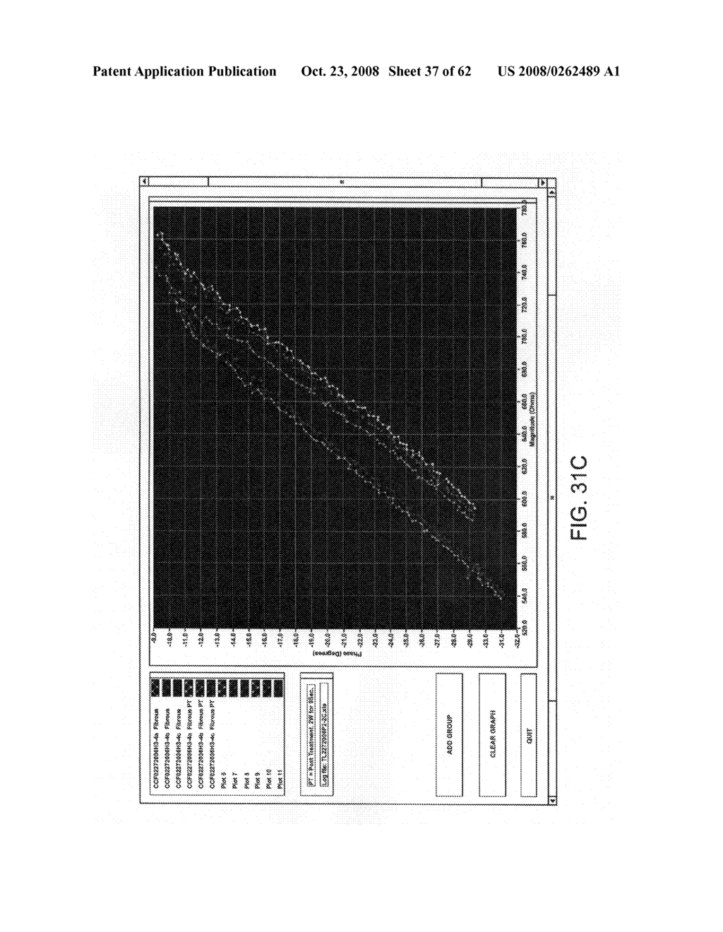 Thrombus removal - diagram, schematic, and image 38